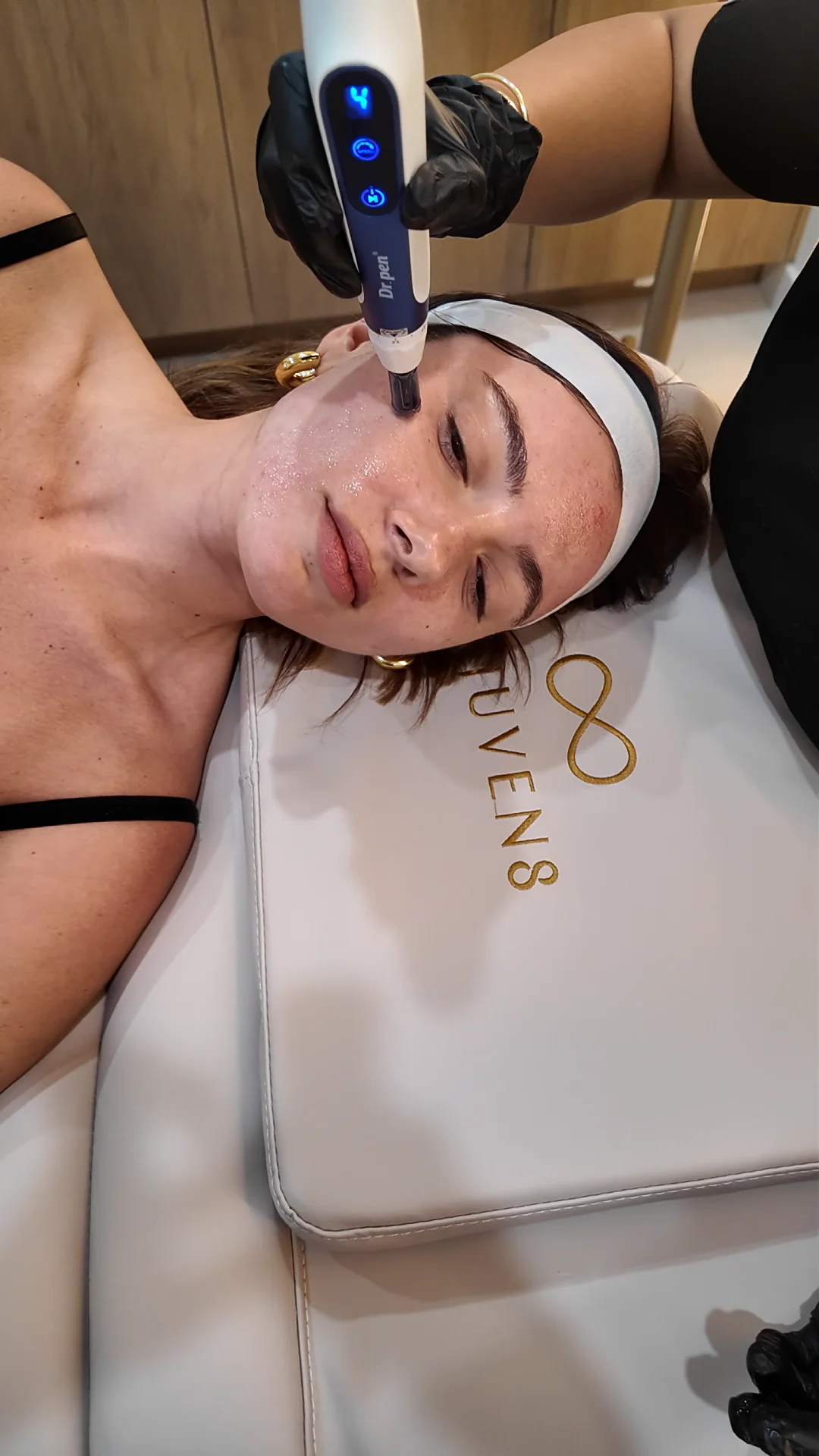 A microneedling pen on a client's cheek as she lies on the Rejuven8 pillow