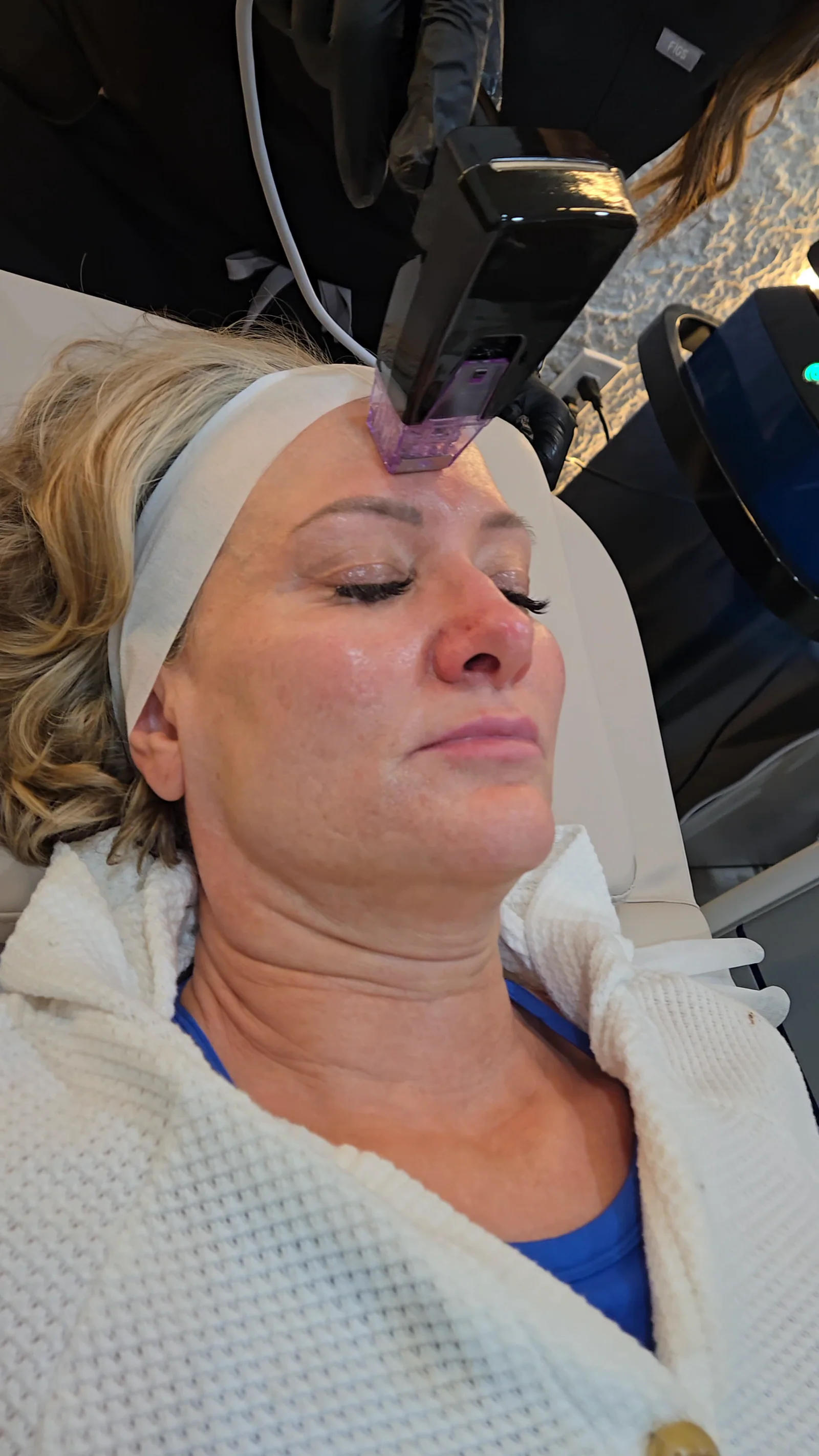 A practitioner holds an RF microneedling handpiece to the forehead of a client resting in a white robe, the device screen behind her